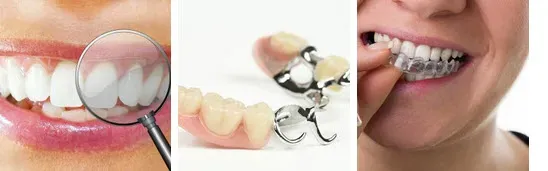 Zahnprothetik Vasi-Dental